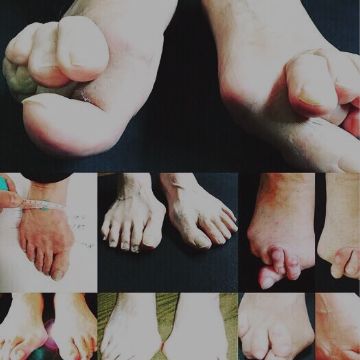 静岡 フルオーダーメイドシューズ 靴 友樹 外反母趾 インソール