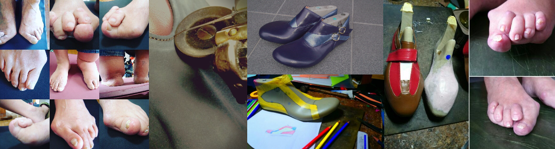 静岡 フルオーダーメイドシューズ 靴 友樹 外反母趾 インソール