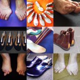 オーダー靴,オーダーメイドシューズ,オーダーメイド靴,外反母趾